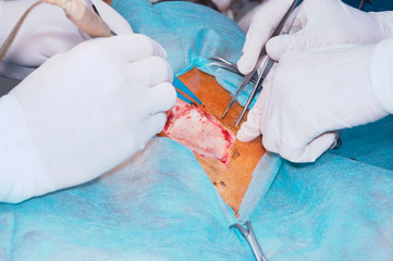 Cutting of the skin of the surgical site (the concept of surgery)