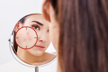 Young woman with acne skin in red aim.
