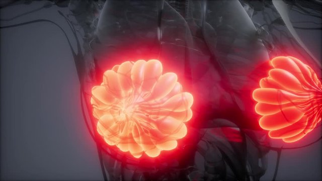 3d rendered medically accurate illustration of an obese womens mammary glands