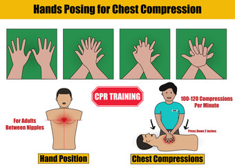 Hands Posing for Chest Compressions Step in CPR Emergency Rescue Process Training on Adult Human Manikin - Info Graphic Flat Design
