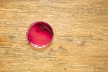 Staphylococcus aureus bacteria in blood agar plate