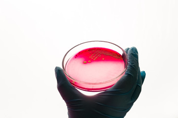 Petri dish with Staphylococcus bacteria in medical laboratory