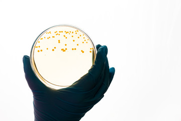 E.coli Escherichia bacteria in Petri dish