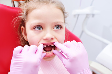 Little girl sitting on dental chair in pediatric dentists office. Early prevention, oral hygiene and milk teeth care.