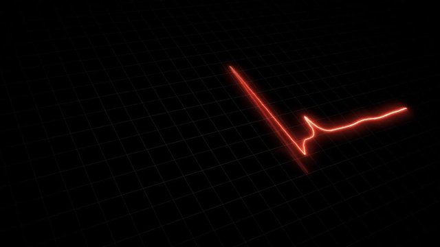 Loopable: EKG Monitor. Blue ECG monitor shows healthy heart beat. Seamless loop. 4k