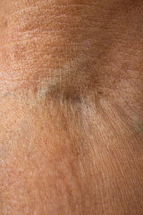 Naklejka premium Senior woman's wrinkled foldable joint of the arm, Close up & Macro shot, Selective focus, Body part, Healthcare concept