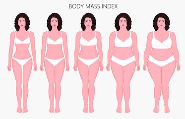 Vector illustration Human body mass Index, European woman from lack of weight to obesity Front view. For advertising of cosmetic plastic procedures, stomach shunting, diet, medical publications