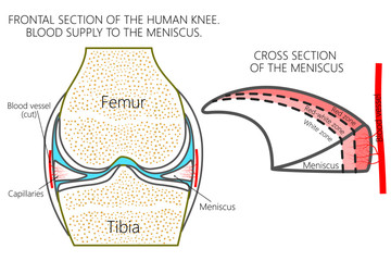 Vector illustration. Frontal section of a healthy human knee, blood supply of the meniscus (red, red-white and white zones). For advertising, medical publications - obrazy, fototapety, plakaty