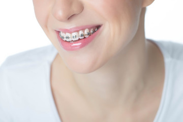 Obraz premium Woman with braces 