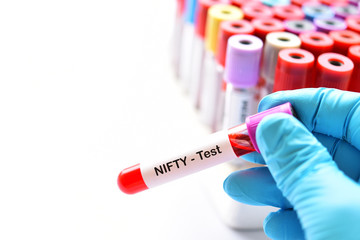 Blood sample for NIFTY or Non Invasive Fetal Trisomy test, diagnosis for fetal Down syndrome in pregnancy woman