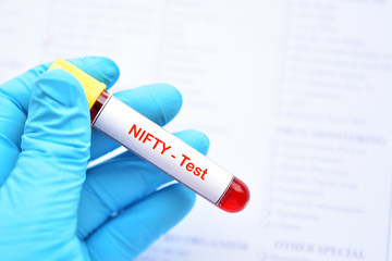 Obraz premium Blood sample for NIFTY or Non Invasive Fetal Trisomy test, diagnosis for fetal Down syndrome in pregnancy woman