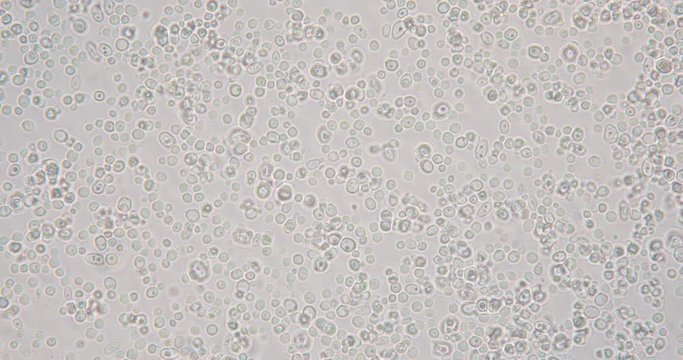 Budding yeast cell under the microscope.