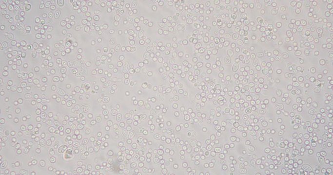 Budding yeast cell under the microscope.