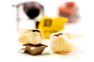 little miniature work tools fixing the problem with big caries on milk tooth molar