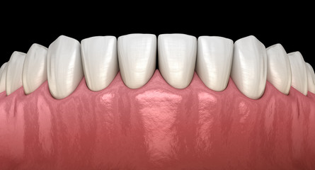 Mandibular human gum and teeth. Medically accurate tooth 3D illustration