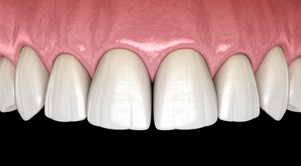 Maxillary human gum and teeth. Medically accurate tooth 3D illustration