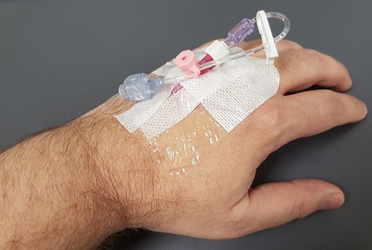 Arm eines m&auml;nnlichen Partienten mit Infusionskan&uuml;le