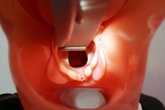 Intubation tube in airways. Performance of an orotracheal intubation on a simulation mannequin dummy during medical training to control of the airway. General Anesthesia. Medical manipulation.