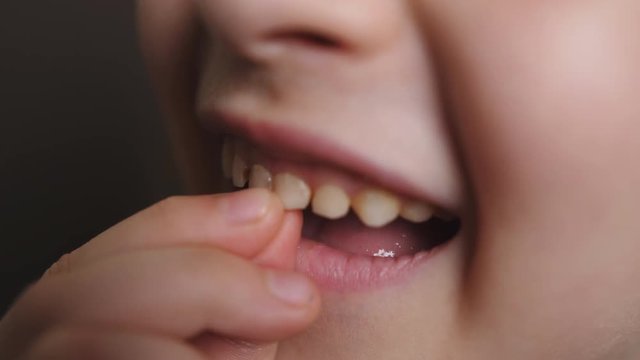 Clouse up a cute young girls wobbles and shakes her loose tooth in an effort to remove it.