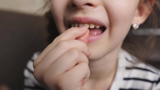 The little girl's hand loosens a tooth in the mouth.