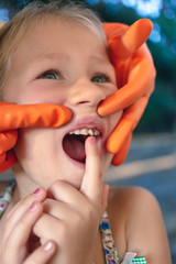 The doctor is trying to see the mouth of a little girl with an orthodontic appliance and crooked...