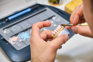Technician dental is working with complete lower and upper metal ceramic prosthesis dental. Dental technician works by brush with jaw model
