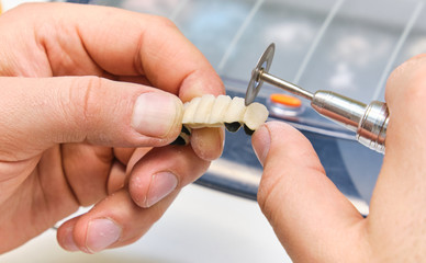 Dental technician or dentist working with tooth dentures in his laborator