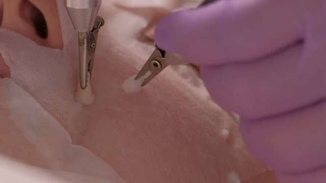 Close-up. The beautician in lilac gloves begins to make the procedure with a rejuvenating effect using electric electrodes. Woman with facial mask in the cosmetology center. Macro shooting.