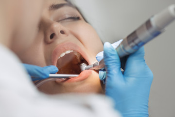 Dentist doing a dental treatment on a female patient.