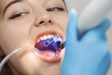 Dentist doing a dental treatment on a female patient.