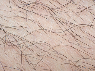 Macro Photo of Human Skin with Hair