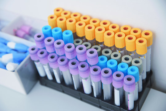 Collection of blood tests and their study, carrying out various tests with blood samples