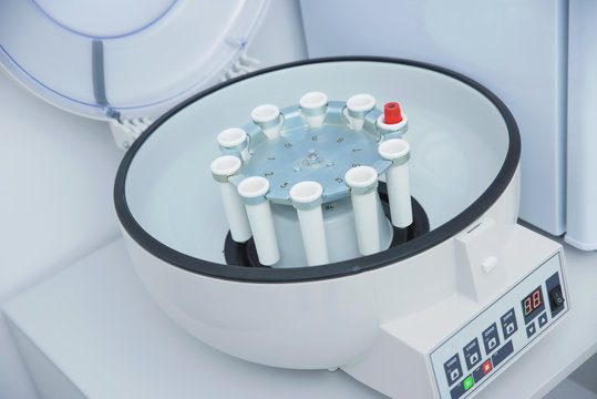 Collection of blood tests and their study, carrying out various tests with blood samples