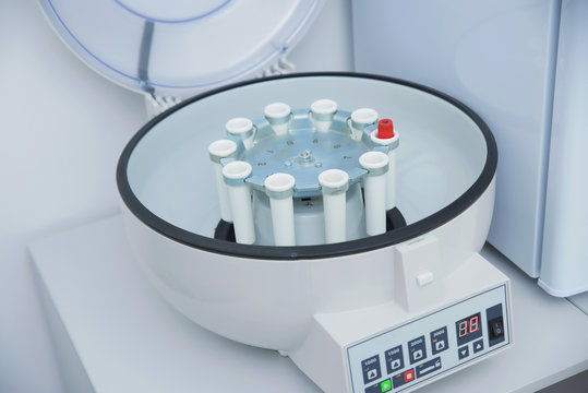 Collection of blood tests and their study, carrying out various tests with blood samples