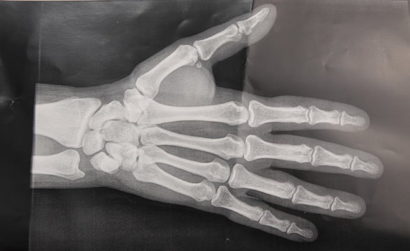 7 Best Radiographie Images Stock Photos Vectors Adobe Stock