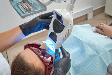 View from above of procedure of whitening of teeth 