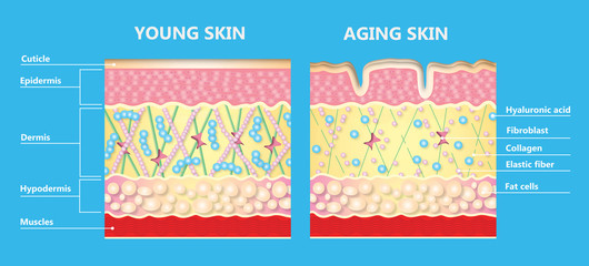 The diagram of younger skin and aging skin - obrazy, fototapety, plakaty