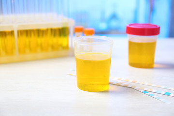 Container with urine sample for analysis on table in laboratory