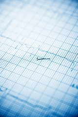 Electrocardiogram close up