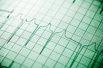 Electrocardiogram close up