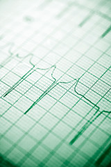 Electrocardiogram close up