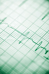 Electrocardiogram close up