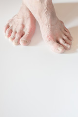 Fototapeta premium The pair of feet and toes that are rough, stalk and dry of the e