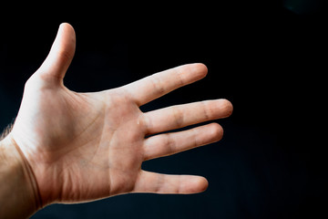 Adult hand with Raynaud's Syndrome - Phenomenon. Close up hand with fingers on dark background with copy space