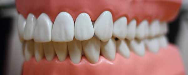 Healthy teeth in layout of jaw close up - medical equipment in the dental office
