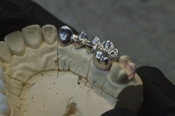 Plaster model of the upper and lower jaw of the patient of dental clinic fixed on the stand,...