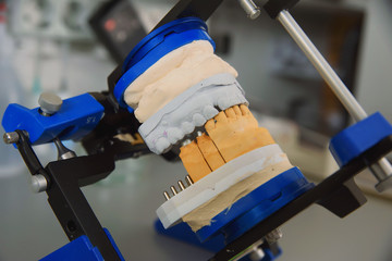 Plaster model of the upper and lower jaw of the patient of dental clinic fixed on the stand, tripod, for tests