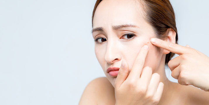  ニキビを潰す女性