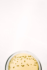 E.coli Escherichia bacteria on yellow agar plate