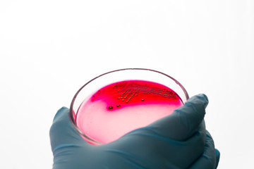 Hand holds Petri dish with Staphylococcus bacteria